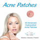 Body Assist Acne Patches