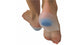 My Feet Silicone Gel Heel Spur Cushion Large